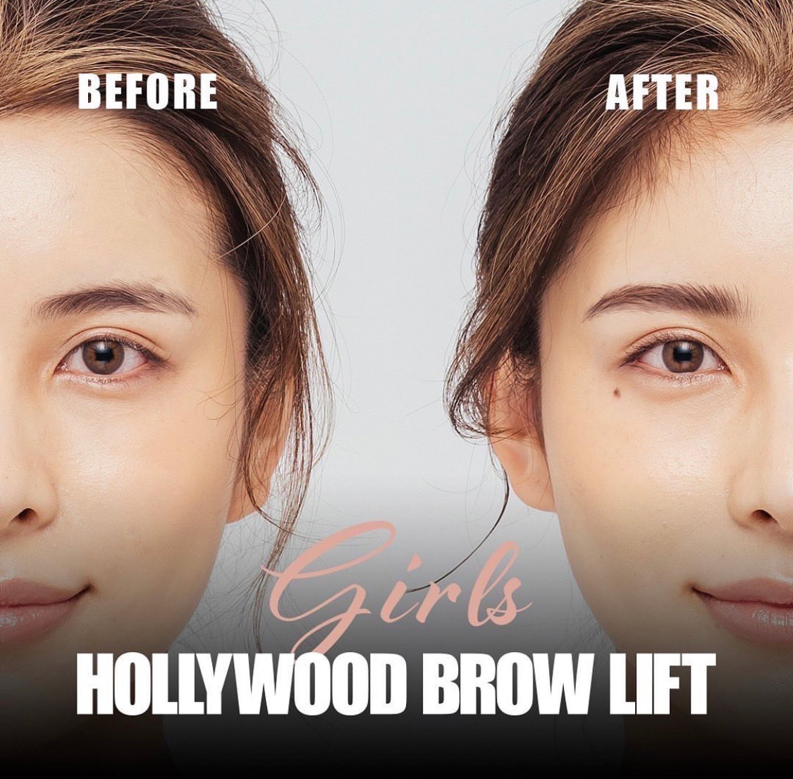 HOLLYWOOD BROW LIFT