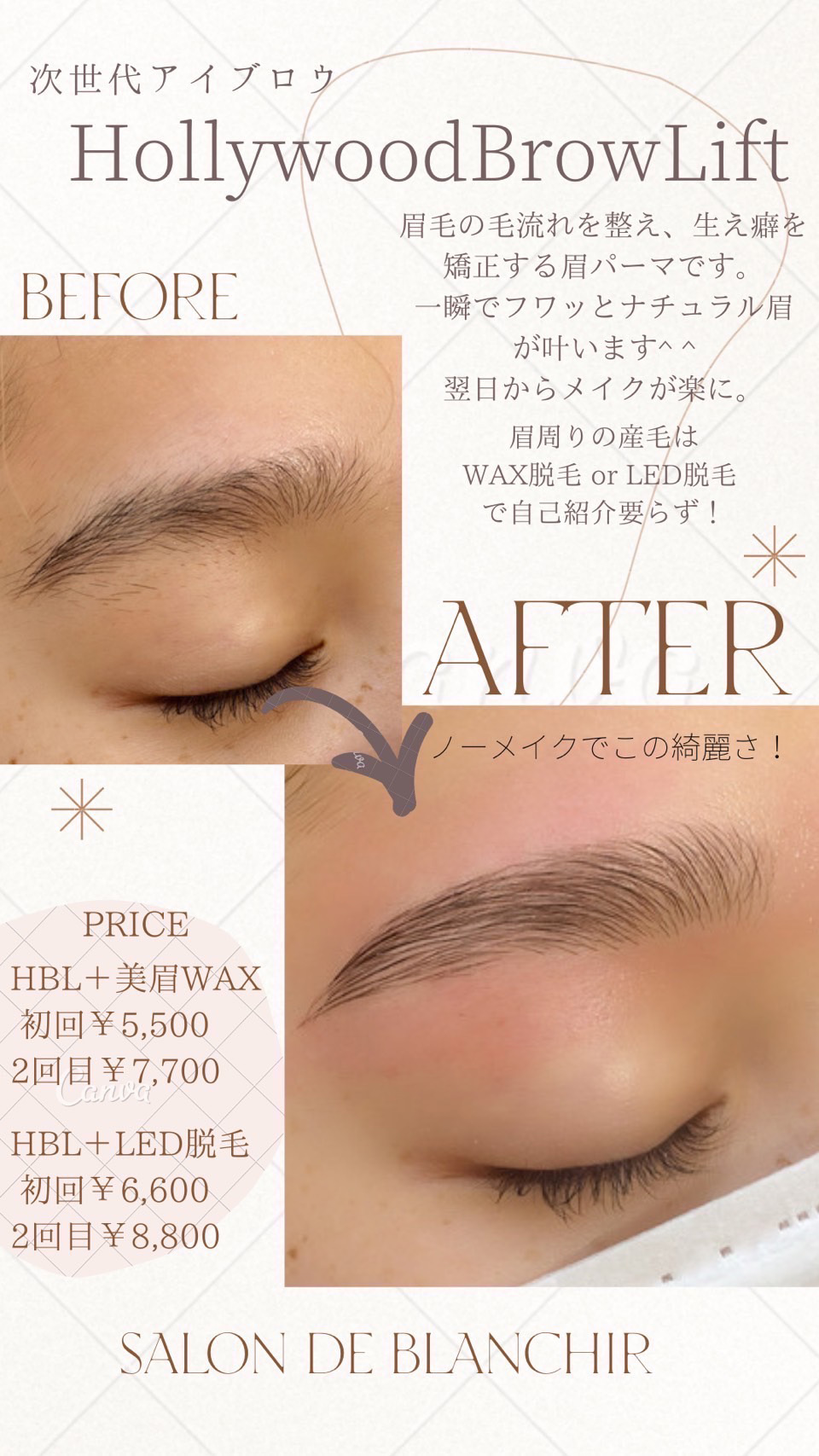 HOLLYWOOD BROW LIFT